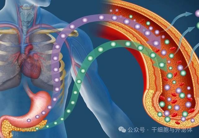 新临床：17名糖尿病患者接受干细胞来源β细胞治疗，不再依赖胰岛素